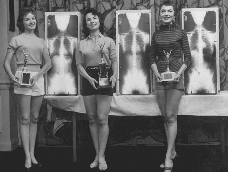 1 °, 2 ° y 3 ° lugar en el concurso de postura correcta de Miss posan con trofeos y sus rayos X (1956)
