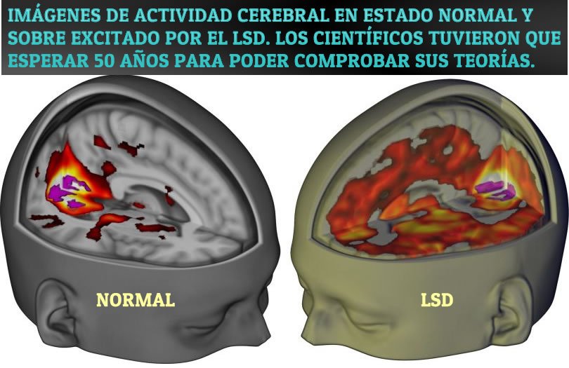 Efectos del LSD sobre el cerebro humano