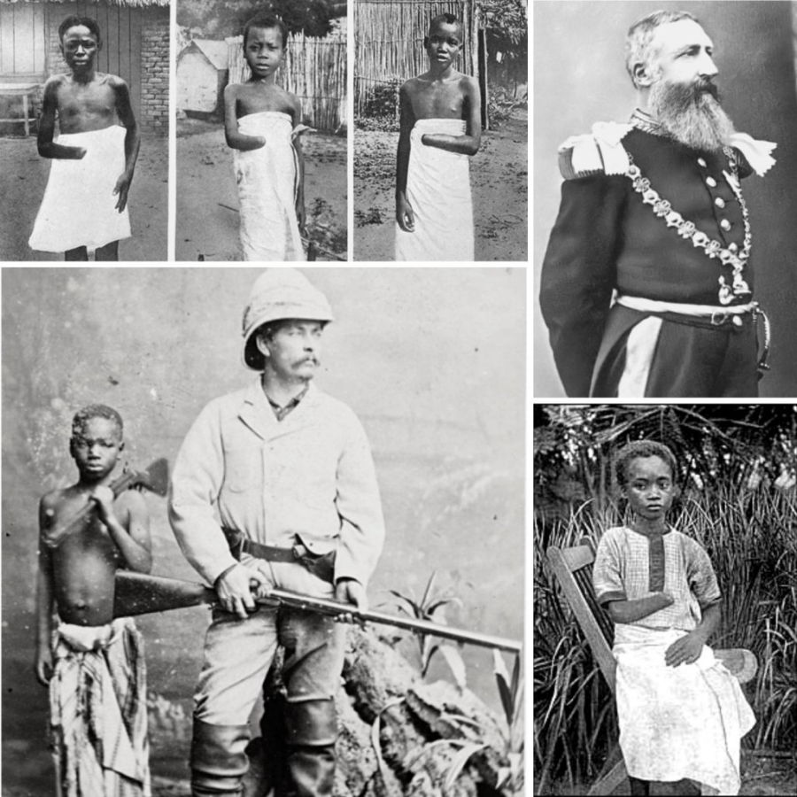 Pequeño collage en el que podemos ver Leopoldo II, al explorador y comerciante esclavista Stanley, y a varios niños que han sido privados de una de sus manos como castigo
