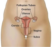 Cáncer uterino