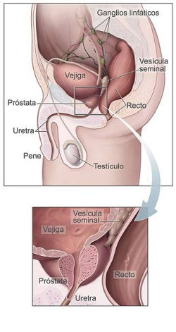 Próstata
