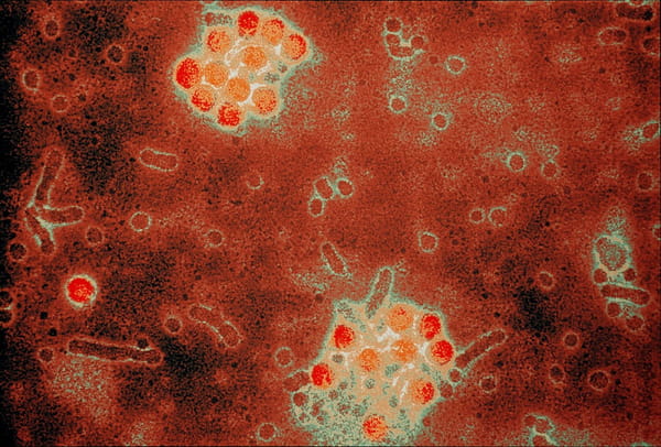 Virus de la hepatitis B